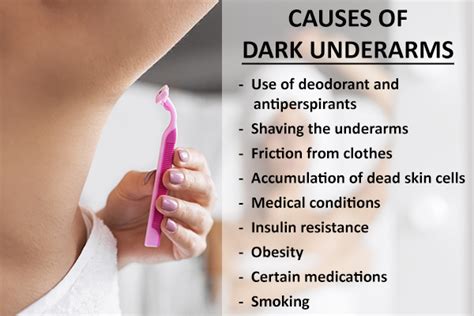 Laser Treatment For Dark Underarms - Quotes Trendy