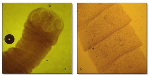 a: Scolex of Cotugnia sp. illustrates four cup-shaped suckers, b: Few... | Download Scientific ...