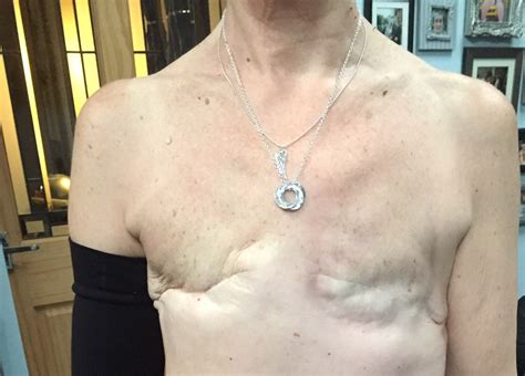 5 years after remission, woman gets mastectomy tattoo on her chest | Fox News