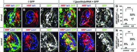 Paxillin function is required for the fidelity of LMC motor axon limb... | Download Scientific ...