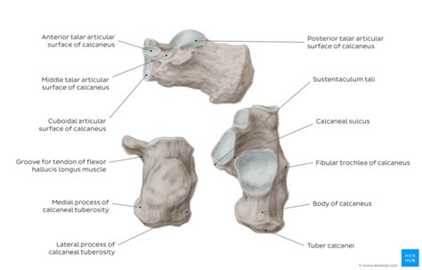 Calcaneal Spurs - Physiopedia