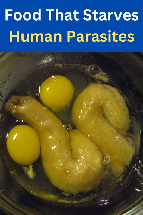 Main Symptoms of a Parasitic Infection | Health and nutrition, Healing food, Natural health remedies