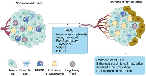 Role of Transarterial Chemoembolization in the Treatment of Hepatocellular Carcinoma