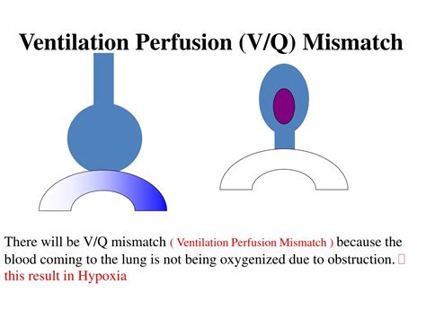 PPT - Obstructive Airway Disease PowerPoint Presentation, free download ...