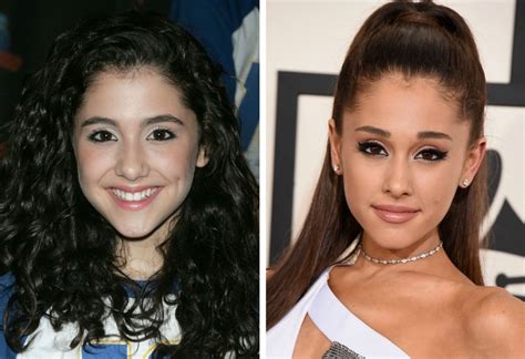 Ariana Grande what plastic surgery did she do?