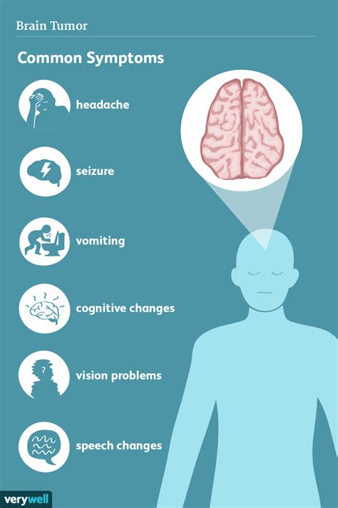 Brain Tumor Symptoms: Headaches, Seizures, Dizziness & More