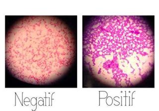 PENGUJIAN LABORATORIUM UNTUK MENENTUKAN SIFAT BAKTERI GRAM POSITIF ATAU ...