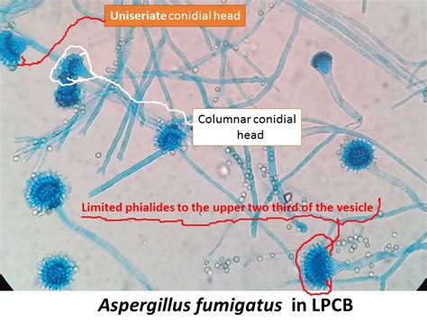 Aspergillus: Introduction, Classification, Colony Morphology, Patho