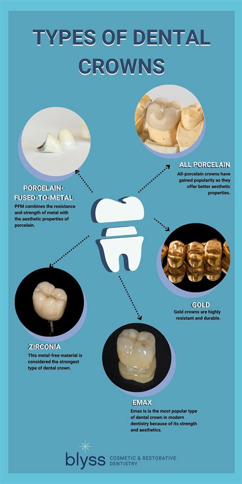 Types of Dental Crowns: Insider Tips to Choose the Best One for You