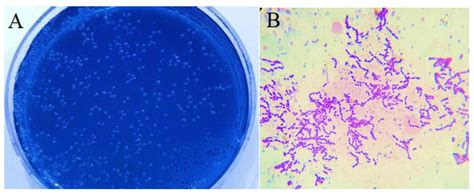 The Prevalence of Streptococcus Mutans with Different ABO Blood Groups ...