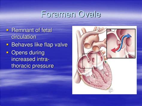 PPT - Atrial Septal Defect PowerPoint Presentation, free download - ID ...