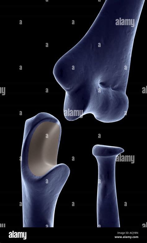 Coronoid fossa hi-res stock photography and images - Alamy