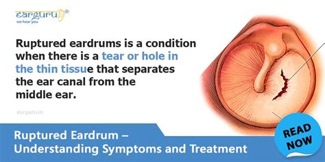 Ruptured Eardrum causes, symptoms and treatment