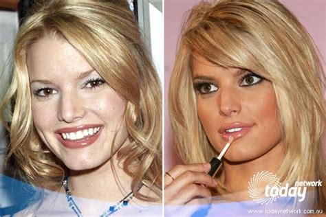 trendystyle: Celebrities Jessica Simpson Before & After Plastic Surgery