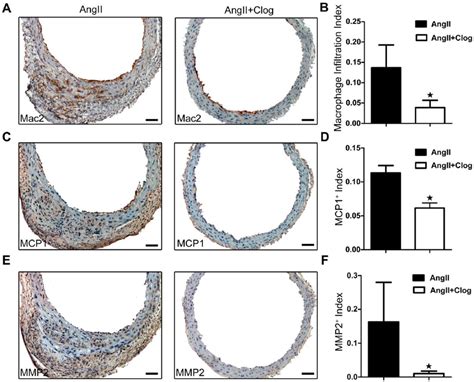 Platelet inhibition contributes to impaired inflammatory response and ...