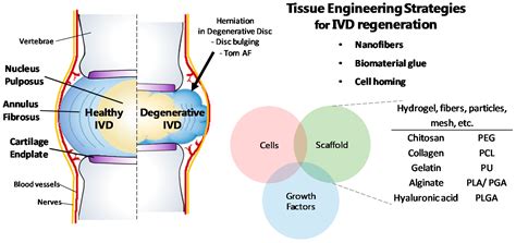 Stem Cells Degenerative Disc Disease - Captions Quotes