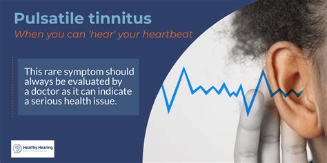 Pulsatile tinnitus - when you can hear your pulse