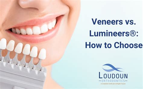 Veneers vs. Lumineers®: How to Choose