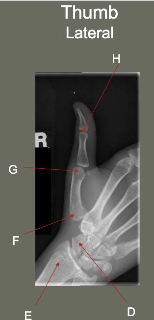 Thumb Lateral Diagram | Quizlet