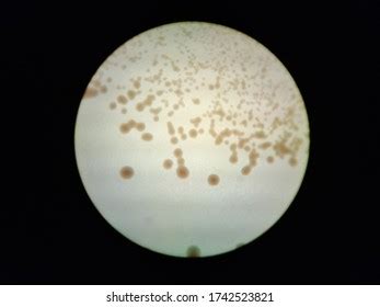 Bacterial Colonies Under Microscope Stock Photo 1742523821 | Shutterstock