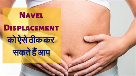 Navel Displacement Treatment using Acupressure Therapy | Shri Jagmohan Sachdeva - YouTube