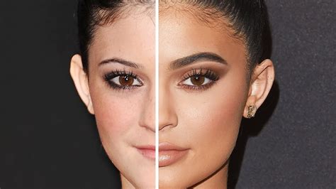 KYLIE JENNER: Before and After Plastic Surgery - YouTube