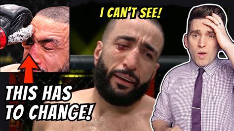 Doctor Reacts to HORRIFIC Eye Poke! Belal Muhammed vs Leon Edwards UFC ...