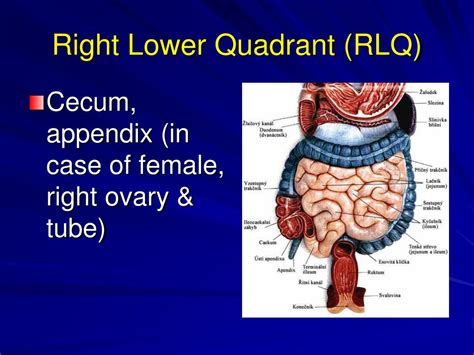 Pain Lower Right Quadrant Anatomy