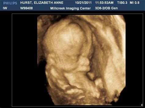 The Hurst Family: Some Ultrasound Pics of our Baby Boy