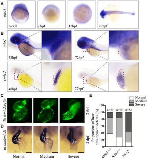 Heart development defects in zebrafish. (A) Whole-mount in situ ...