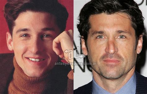 » 20 Celebrity nose jobs |Before and After | Photos, Biography and Family