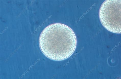 Sea urchin egg - Stock Image - P633/0039 - Science Photo Library