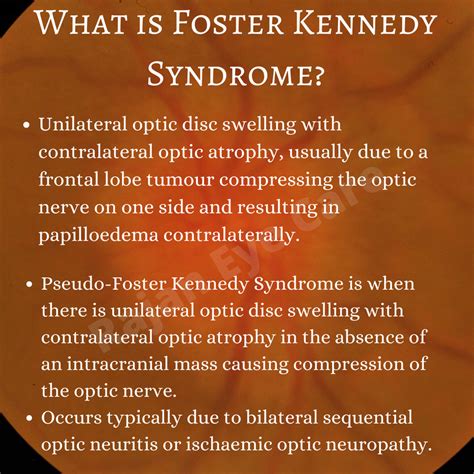 Weekend Bytes - What is Foster Kennedy Syndrome?