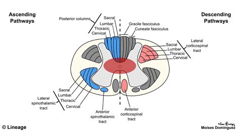 Spinal Cord Lesions - Neurology - Medbullets Step 2/3