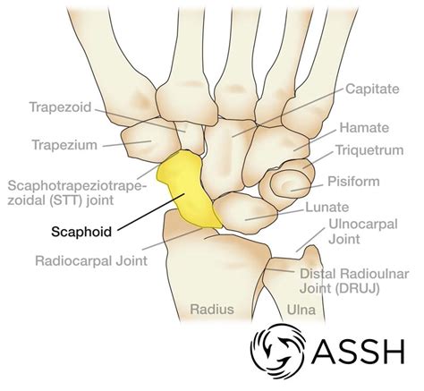 Wrist Anatomy | Kirkland, WA | EvergreenHealth