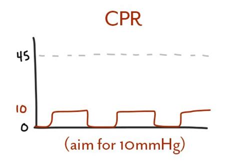 low end tidal co2 during cpr - Has Major Portal Galleria Di Immagini