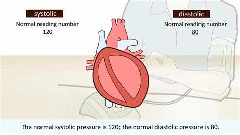 Hypertension Animation