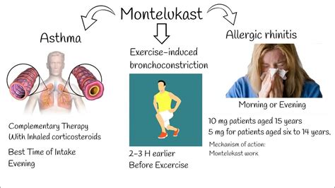 Montelukast - Indications, side effects. Singular indications. - YouTube