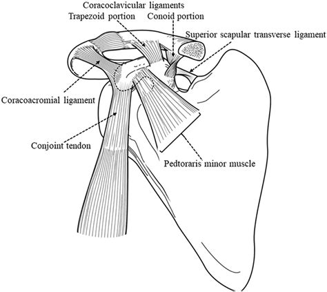 Muscles and ligaments attached to the coracoid process. The ...