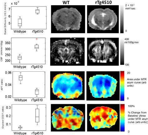 Quantitative MRI measurements that discriminate tau pathology from ...