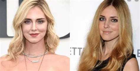 Chiara Ferragni Before and After Plastic Surgery Including Boob Job and ...