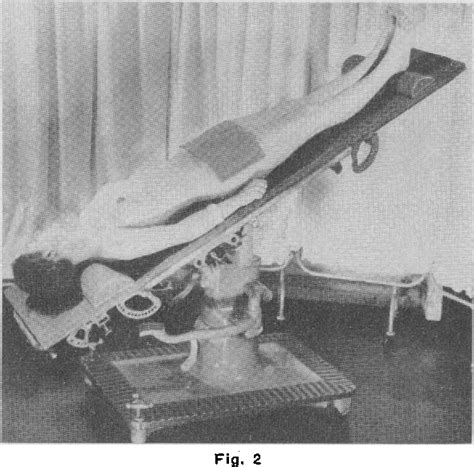 Figure 2 from The physiology and complications of the Trendelenburg ...