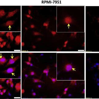 Nuclear localization of BRAF V600E in melanoma cells. SkMel-28 and ...