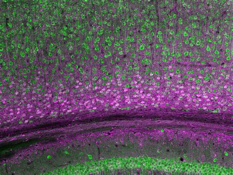 Neuroscience | ASU Biodesign Institute