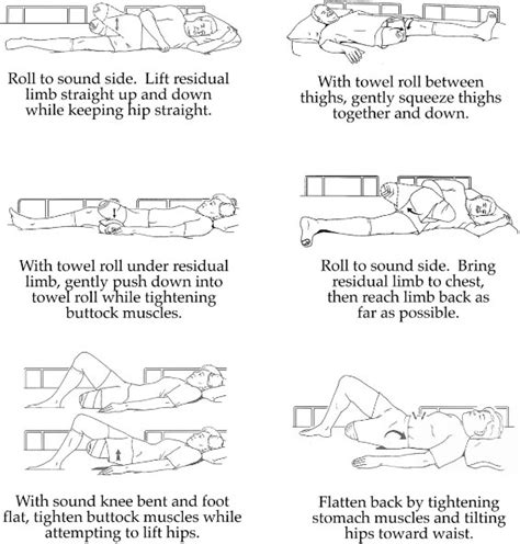 Exercises – Sola Prosthetics