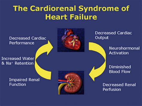 Cardio-Renal Syndrome Type 2: Epidemiology, Pathophysiology, and ...