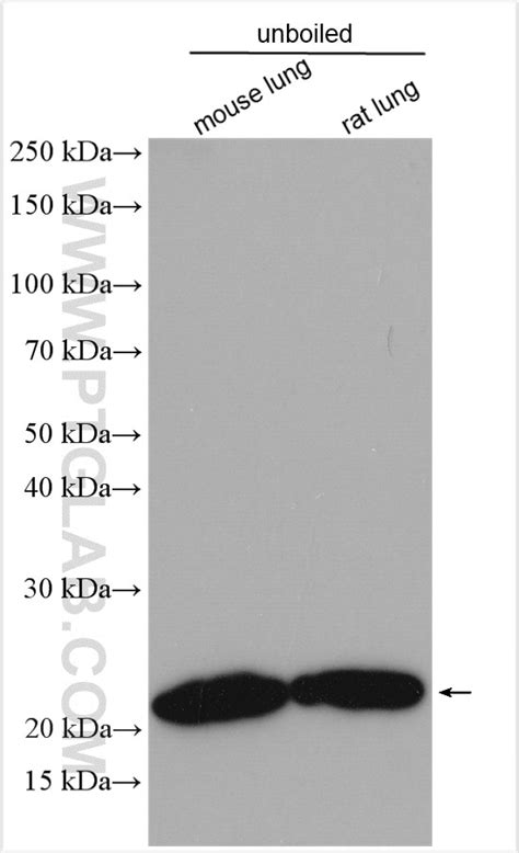 Claudin 5 antibody (29767-1-AP) | Proteintech