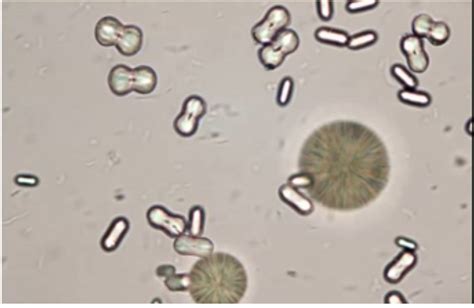 Urinalysis - Microscopic (Renal) Flashcards | Memorang | Medical laboratory science, Microscopic ...