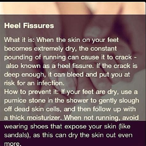 Heel Fissures | Heel fissures, Heels, Extremely dry