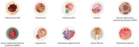 Lungs Diseases: Signs, Symptoms, Diagnosis, Screening & its Treatment - Dr Lal PathLabs Blog